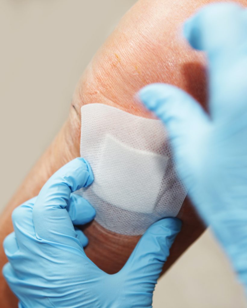 Nurse is changing bandage to a patient